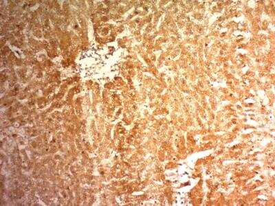 Immunohistochemistry-Paraffin: Glypican 3 Antibody (1G12) - IHC-Prediluted [NBP2-48396]