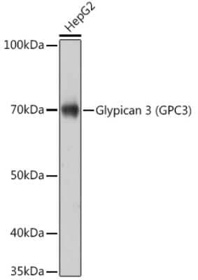 Western Blot: Glypican 3 Antibody (7M2X9) [NBP3-15428]