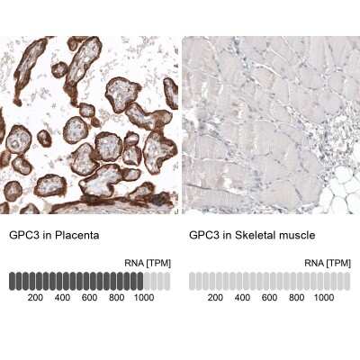 Immunohistochemistry-Paraffin: Glypican 3 Antibody (CL12711) [NBP3-18542]