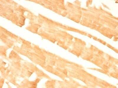 Immunohistochemistry-Paraffin: Glypican 3 Antibody (GPC3/863) - Azide and BSA Free [NBP2-47762]