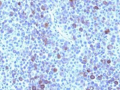 Immunohistochemistry-Paraffin: Glypican 3 Antibody (GPC3/863) - Azide and BSA Free [NBP2-47762]