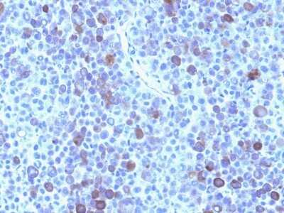 Immunohistochemistry-Paraffin: Glypican 3 Antibody (GPC3/863) [NBP2-44486]