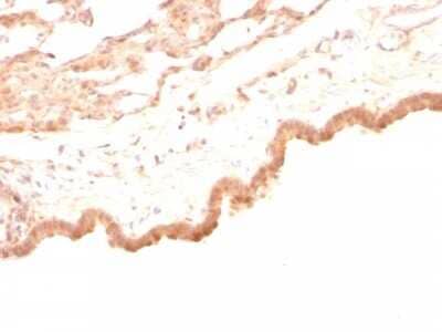 Immunohistochemistry-Paraffin: Glypican 3 Antibody (GPC3/863) [NBP2-44486]