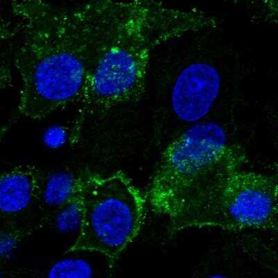 Immunocytochemistry/ Immunofluorescence: Glypican 3 Antibody [NBP1-85226]