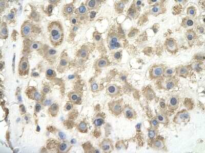 Immunohistochemistry: Glypican 3 Antibody [NBP2-36558]