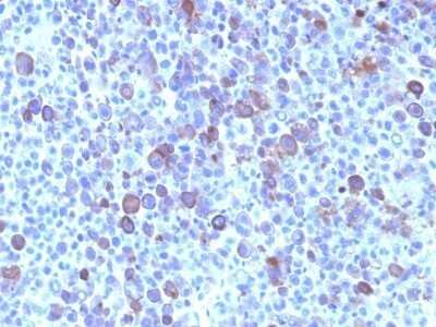 Immunohistochemistry-Paraffin: Glypican 3 Antibody (SPM595) - Azide and BSA Free [NBP2-47761]