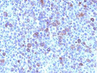 Immunohistochemistry-Paraffin: Glypican 3 Antibody (SPM595) - IHC-Prediluted [NBP2-48397]