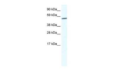 Western Blot: Glypican 3 Antibody [NBP2-36558]
