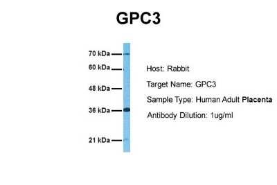 Western Blot: Glypican 3 Antibody [NBP2-36558]