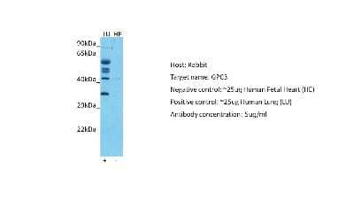 Western Blot: Glypican 3 Antibody [NBP2-36558]
