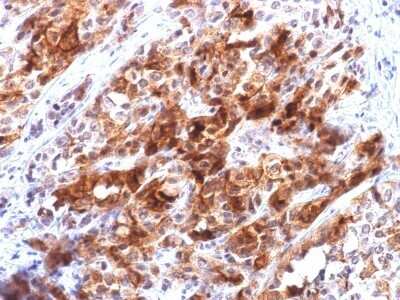 Immunohistochemistry-Paraffin: Glypican 3 Antibody (rGPC3/863) - Azide and BSA Free [NBP2-54304]