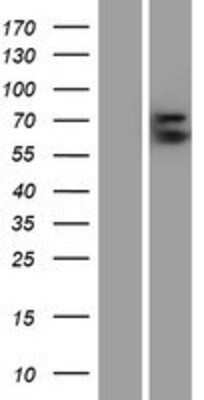 Western Blot: Glypican 3 Overexpression Lysate [NBP2-10593]