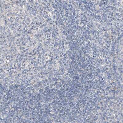 Immunohistochemistry-Paraffin: Glypican 4 Antibody [NBP1-87697]