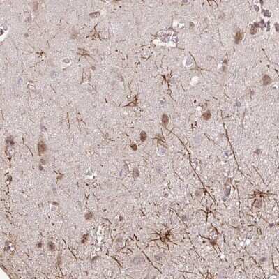Immunohistochemistry: Glypican 5 Antibody [NBP2-48723]