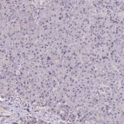 Immunohistochemistry-Paraffin: Glypican 5 Antibody [NBP2-48723]