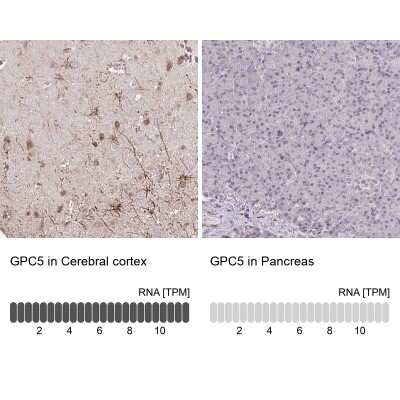 Immunohistochemistry-Paraffin: Glypican 5 Antibody [NBP2-48723]