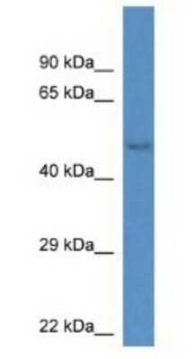 Western Blot: Gm13178 Antibody [NBP1-74203]