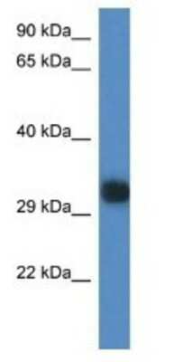 Western Blot: Gm527 Antibody [NBP1-74246]