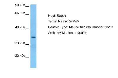 Western Blot: Gm527 Antibody [NBP2-84049]