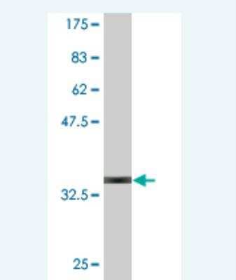 Western Blot: GnRH Antibody (4H3) [H00002796-M01]