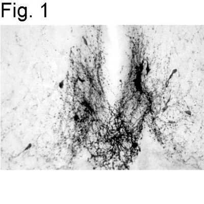 Immunohistochemistry-Paraffin: GnRH Antibody [NB300-506]