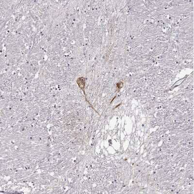Immunohistochemistry-Paraffin: GnRH Antibody [NBP1-89749]