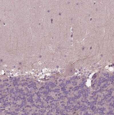Immunohistochemistry-Paraffin: GnRH Antibody [NBP1-89749]