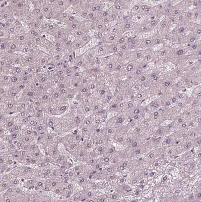 Immunohistochemistry-Paraffin: GnRH Antibody [NBP1-89749]