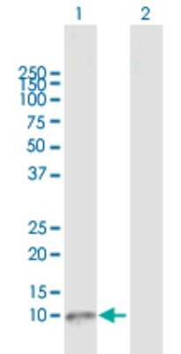 Western Blot: GnRH Antibody [H00002796-D01P]