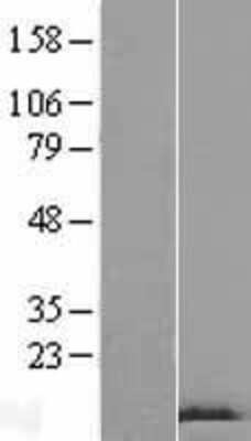 Western Blot: GnRH Overexpression Lysate [NBP2-10712]