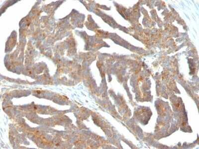 Immunohistochemistry-Paraffin: GnRHR Antibody (F1G4) - IHC-Prediluted [NBP2-48419]