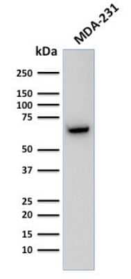 Western Blot: GnRHR Antibody (F1G4) [NBP2-45298]