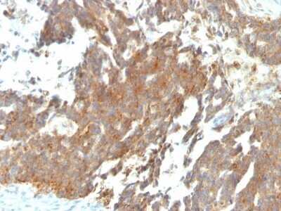 Immunohistochemistry-Paraffin: GnRHR Antibody (GNRHR/768) - IHC-Prediluted [NBP2-48039]