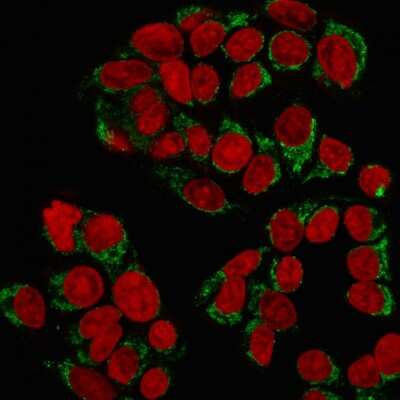 Immunocytochemistry/ Immunofluorescence: GnRHR Antibody (GNRHR/768) [NBP2-45300]