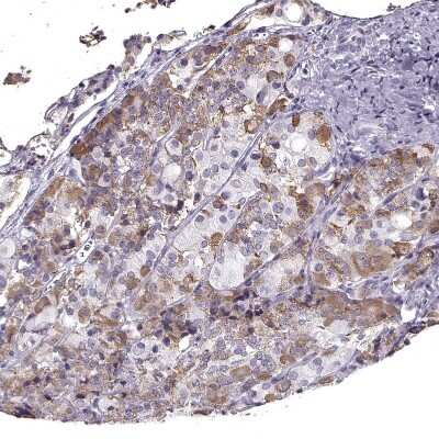 Immunohistochemistry-Paraffin: GnRHR Antibody [NBP2-55552]