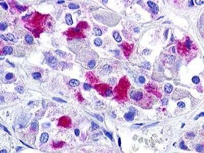 Immunohistochemistry-Paraffin: GnRHR Antibody - BSA Free [NLS209]