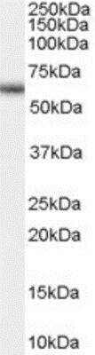 Western Blot: GnRHR Antibody [NB100-55419]