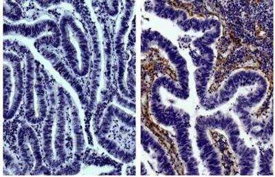 Immunohistochemistry-Paraffin: Goat IgG Isotype Control [NB410-28088]