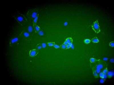 Immunocytochemistry/ Immunofluorescence: Goat anti-Human IgG (H+L) Secondary Antibody [NBP1-74939]