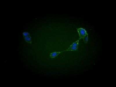 Immunocytochemistry/ Immunofluorescence: Goat anti-Human IgG (H+L) Secondary Antibody (Pre-adsorbed) [NB120-7155]