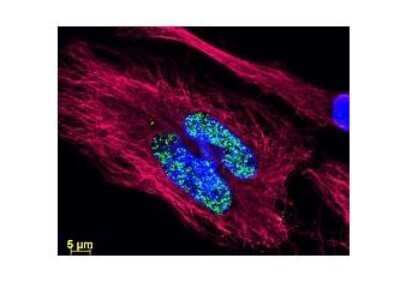 Immunocytochemistry/ Immunofluorescence: Goat anti-Human IgM Heavy Chain Secondary Antibody [NBP2-60670]