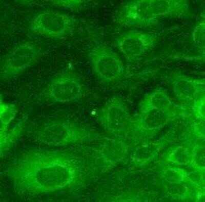 Immunocytochemistry/ Immunofluorescence: Goat anti-Mouse IgG Fc Secondary Antibody [NBP2-60664]