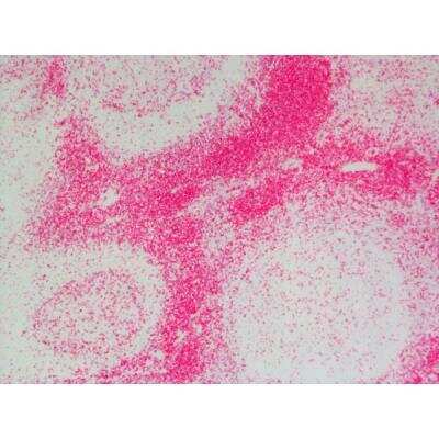 Immunohistochemistry: Goat anti-Rat IgG ImmPRESS(TM) Secondary Antibody [AP Polymer] [MP-5404-NB]