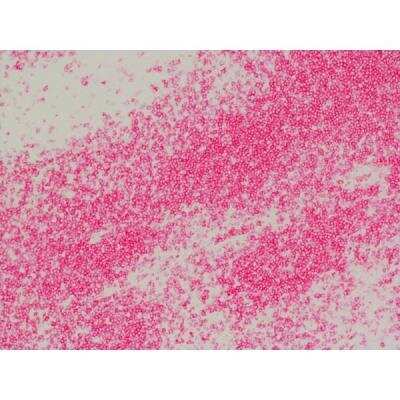 Immunohistochemistry: Goat anti-Rat IgG ImmPRESS(TM) Secondary Antibody [AP Polymer] [MP-5404-NB]