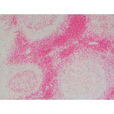 Immunohistochemistry: Goat anti-Rat IgG ImmPRESS(TM) Secondary Antibody [AP Polymer] (Mouse Adsorbed) [MP-5444-NB]