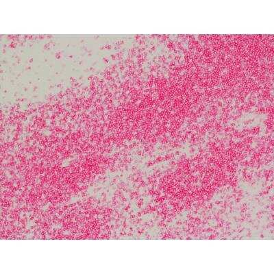 Immunohistochemistry: Goat anti-Rat IgG ImmPRESS(TM) Secondary Antibody [AP Polymer] (Mouse Adsorbed) [MP-5444-NB]