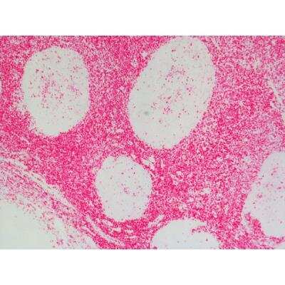 Immunohistochemistry: Goat anti-Rat IgG ImmPRESS(TM) Secondary Antibody [AP Polymer] (Mouse Adsorbed) [MP-5444-NB]