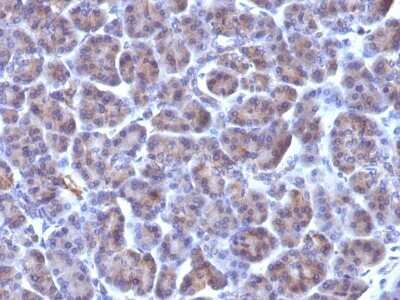 Immunohistochemistry-Paraffin: Golgi Complex Antibody (371-4) - IHC-Prediluted [NBP2-45185]
