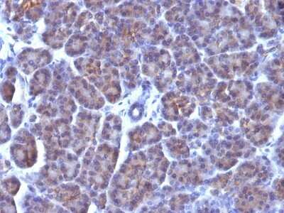 Immunohistochemistry-Paraffin: Golgi Complex Antibody (AE-6) [NBP2-45214]