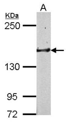 Western Blot: Golgi Glycoprotein 1/GLG1 Antibody [NBP2-16704]